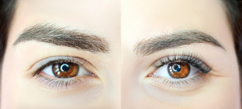 Lash Lift Migraine Therapy IV Lake Forest IL