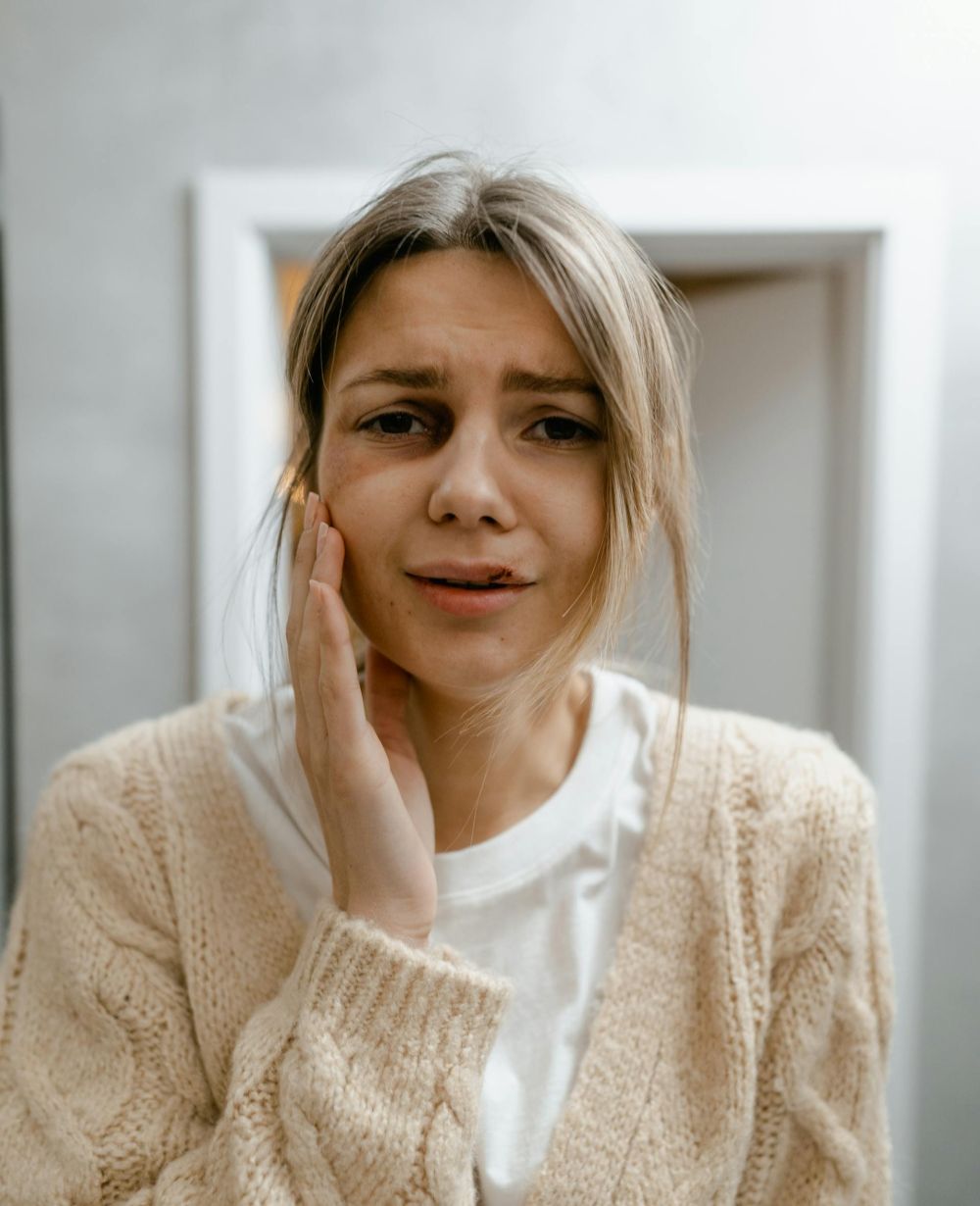 woman with lip injury holding side of face image